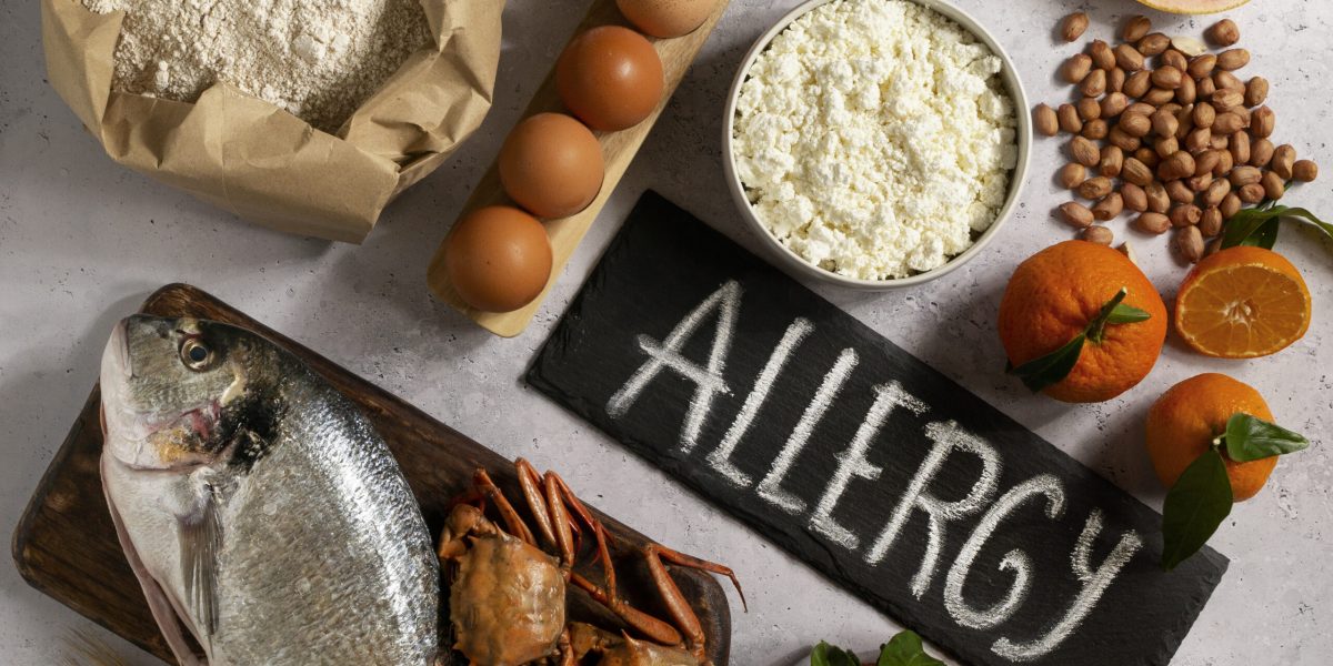 visao-de-alergenos-comumente-encontrados-em-alimentos